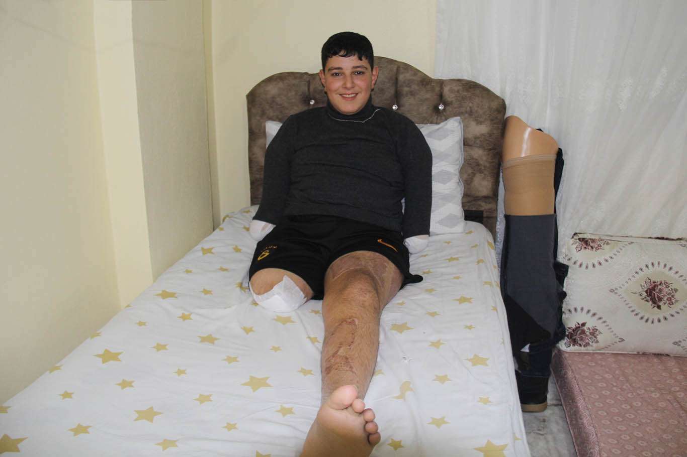 HÜDA PAR Genel Başkanı Yapıcıoğlu, elektrik akımına kapılan küçük Furkan’ı ziyaret etti